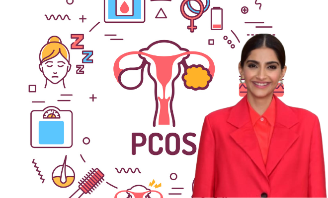 Sonam Kapoor Reveals She’s Struggling With PCOS, Shares Tips On How She Keeps The Symptoms In Check.