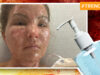 This Texas Woman Suffered Burns After She Used Sanitizer And Went Near A Flame. We’ve To Be More Careful About Our Protective Measures
