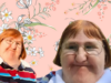 This Disability Blogger Shut Up Haters Who Said She Was “Too Ugly” To Post Selfies With This One Cool Move