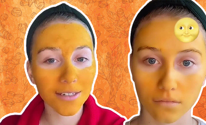 This Woman Went Overboard With Her DIY Turmeric Facial And Ended Up With Yellow Skin For Three Weeks. It’s Hilarious