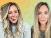 This Influencer Ended Up With A Droopy Eyelid Due To Wrongly Injected Botox. She Is Taking It Like A Champ Though