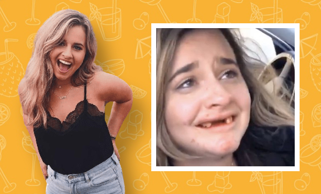 This Girl Got Drunk And Did Something Stupid. She Lost Her Front Teeth!