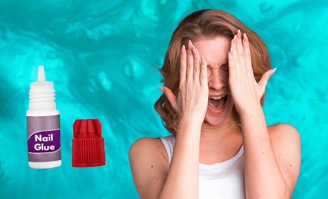 This Woman Accidentally Sealed Her Eye Shut When She Put Nail Glue In Her Eye. She Thought They Were Eye Drops