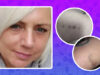 This UK Woman Claims To Have Been Abducted By Aliens Over 50 Times And Has The Bruises To Prove It, She Says