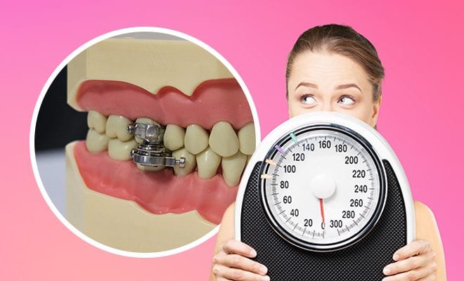 Researchers Create A Weight Loss Device That Locks People’s Jaws Shut To Stop Them From Eating. What Nonsense!