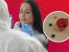 Woman Spends Nearly 40 Years With Plastic Coin Up Her Nose, Finds Out About It During COVID Test!