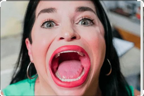 This Woman Just Set The World Record For Having The World’s Biggest Mouth. I Didn’t Even Know That Was A Record That Could Be Set