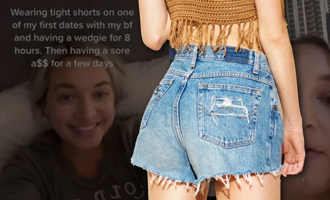 Woman In The US Got Sepsis After Wearing High-Waisted Shorts All Day. Yikes!