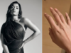 Rashmika Mandanna Opens Up About Downsides Of Getting Laser Treatment. We Totally Feel Her