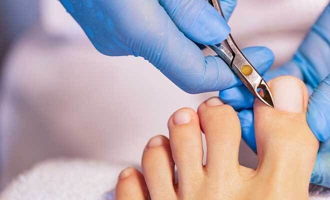 US Woman Gets $1.75M From Salon For Loosing Her Leg During Pedicure! *OMG*