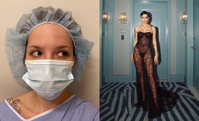 Singer Halsey Walks The 2022 Grammys Red Carpet Three Days After A Surgery, Leaves Early. History Repeats!