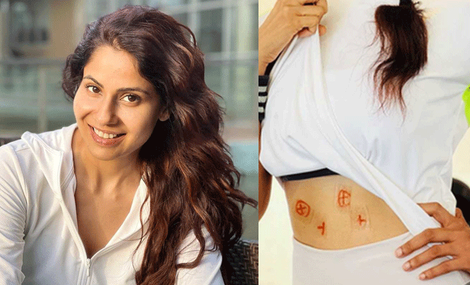 Chhavi Mittal Shares A Pic Of Her Bandaged Belly After Her First Radiotherapy Session Chhavi Mittal Shares A Pic Of Her Bandaged Belly After Her First Radiotherapy Session