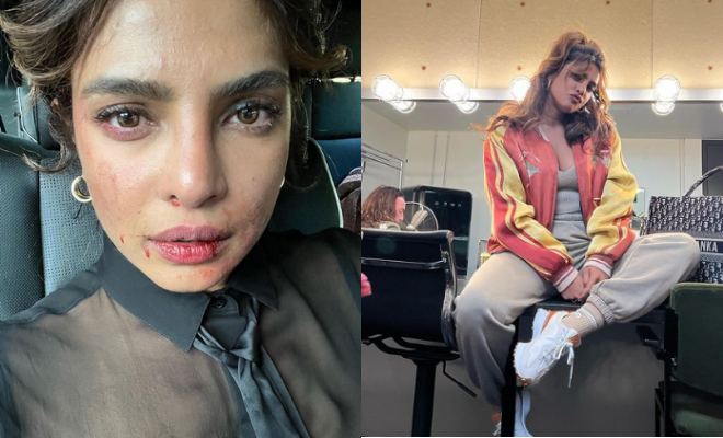 Priyanka Chopra Shares Pic Of Being Bloodied And Bruised On The Set Of Citadel, Says It Was A ‘Tough Day’