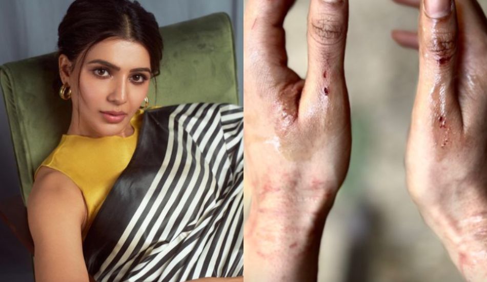 The ‘Perks’ Samantha Ruth Prabhu Got While Shooting ‘Citadel’ Are Not As Cool As You’d Assume!