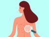 Want Smooth Skin Everywhere? Say Goodbye to Bacne and Butt Acne with These Tips