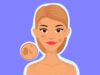 What Is Hypopigmentation? All You Need To Know About This Skin Condition