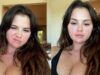 What Is Lupus? Understanding The Chronic Autoimmune Disease Selena Gomez Has