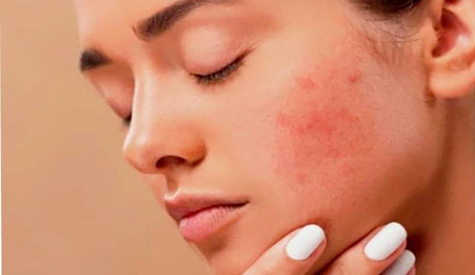 morebeautyImage