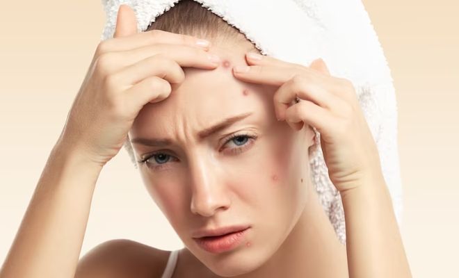 Why-Face-Bleaching-Is-A-Bad-Ideas-Sensitive-Skin-Chemicals