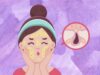 Is Your Beauty Routine Causing Skin Congestion? Find Out!