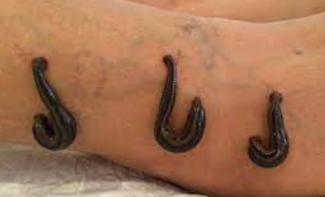 Most-Weird-Bizzarre-Beauty-Treatments-Snail-Facial-Snake-Massage-semen-hair-mask