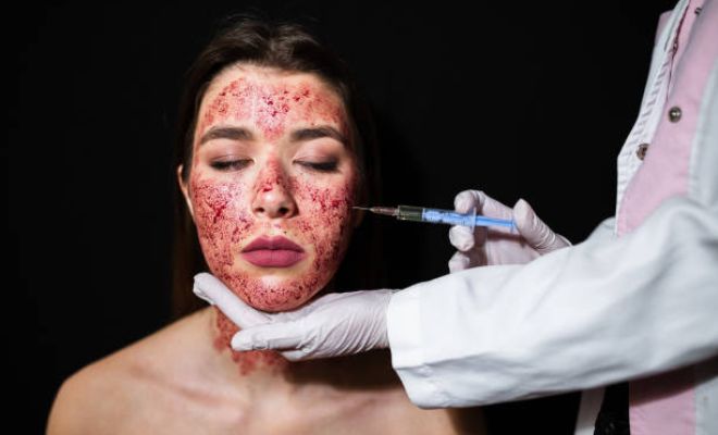 What-Is-The-Vampire-Facial-Expert-Dermatologist-Explains-Rejuvenate-Skin-Acne-Scars-Pigmentation