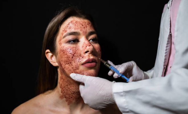 What-Is-The-Vampire-Facial-Expert-Dermatologist-Explains-Rejuvenate-Skin-Acne-Scars-Pigmentation