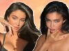 5 Things To Know If You’re Thinking Of Dissolving Your Lips Fillers Like Kylie Jenner