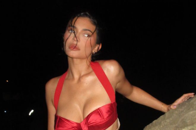 Kylie-Jenner-Lip-Fillers-Dissolving-Things-To-Know-Before-After-Effects-Precautions
