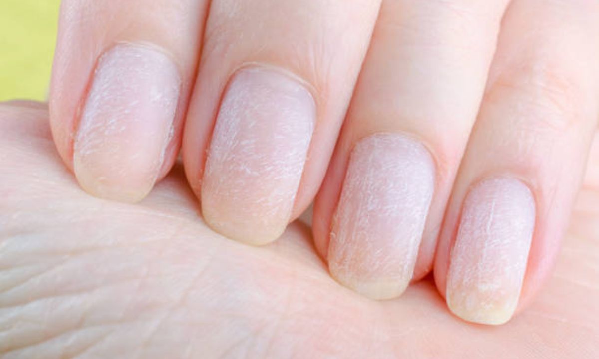 morebeautyImage