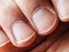 Tired Of Uneven Nail Texture? Try These 3 Hacks For A Smooth Finish!