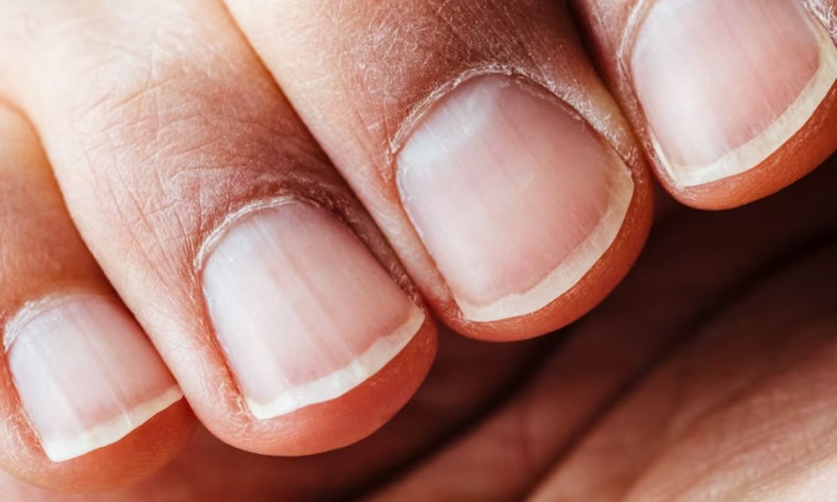 morebeautyImage