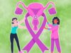 Think You Know Everything About Cervical Cancer? Gynaecologist Debunks 3 Surprising Myths