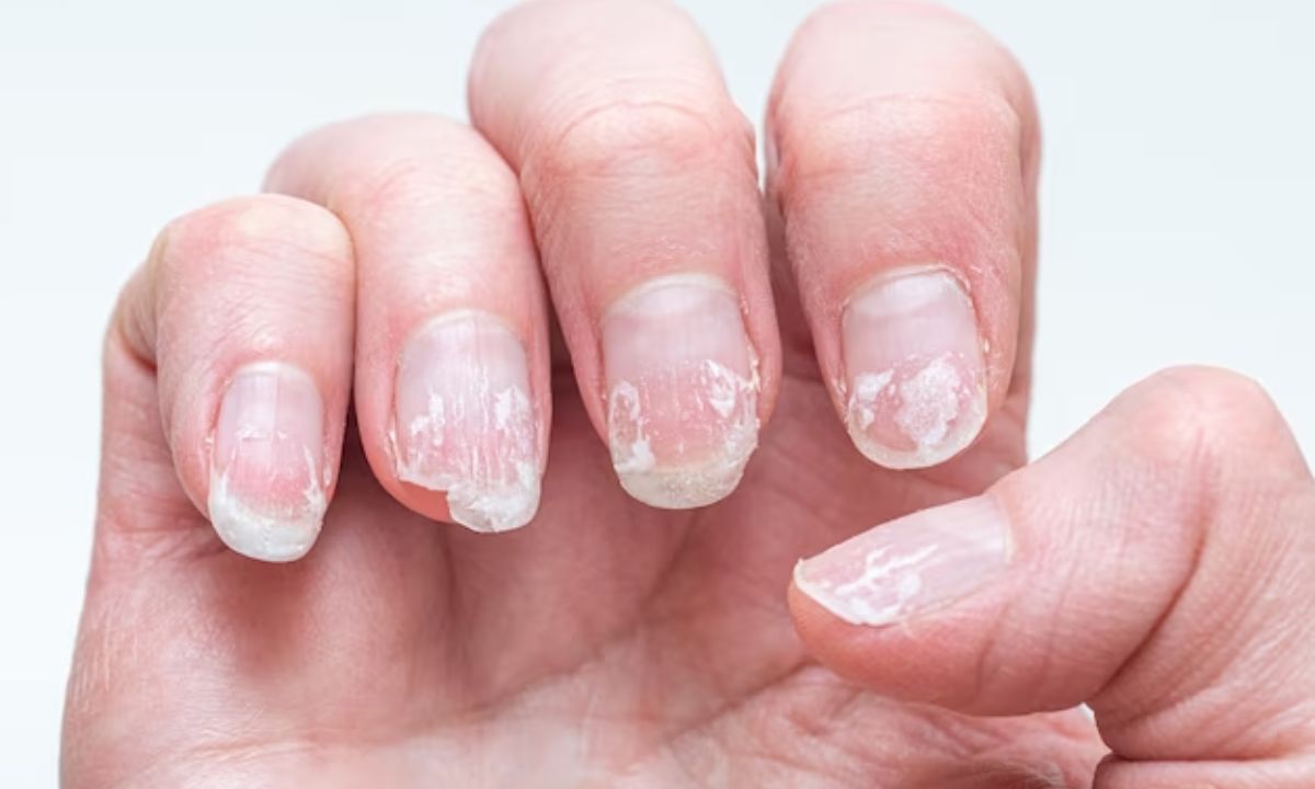 morebeautyImage