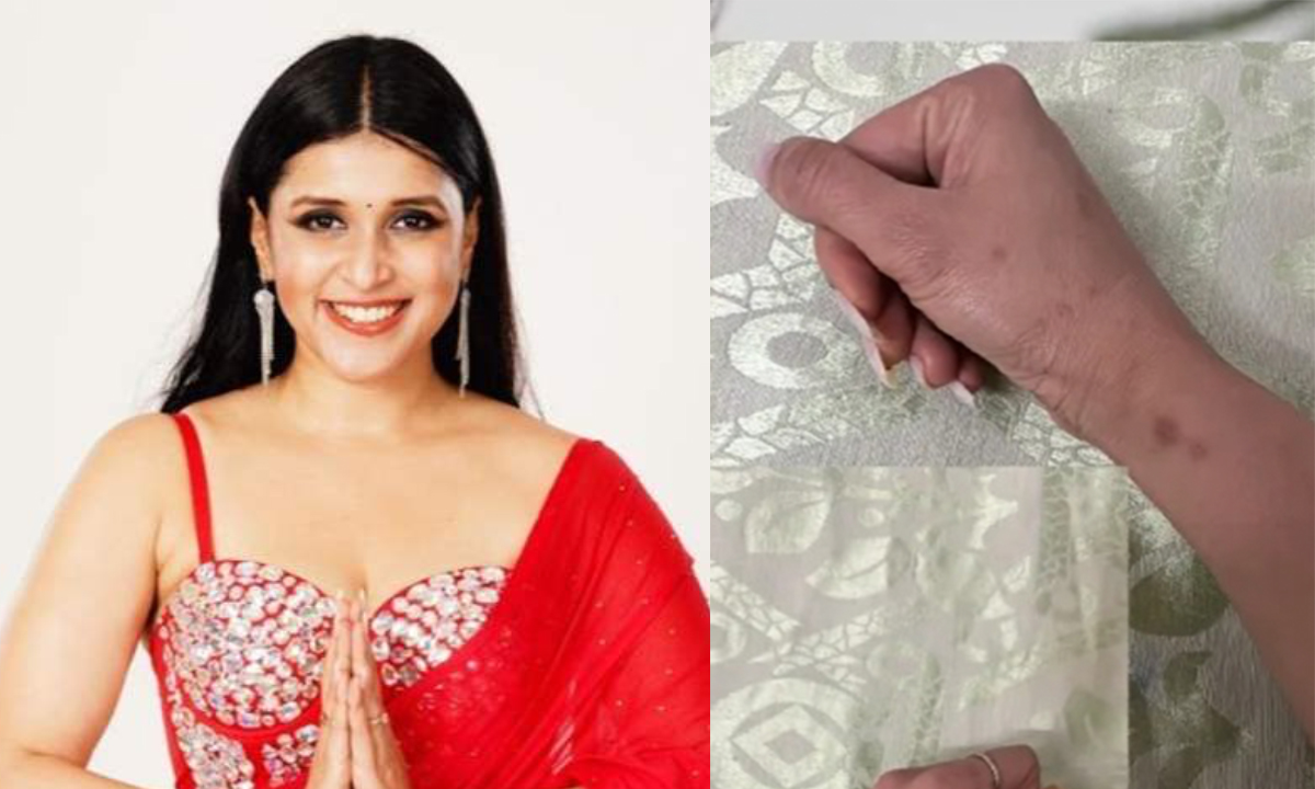 Mannara Chopra Is Still Recovering From Scars She Got From Bigg Boss 17 Mirchi Task. Looks Brutal! Mannara Chopra Is Still Recovering From Scars She Got From Bigg Boss 17 Mirchi Task. Looks Brutal!