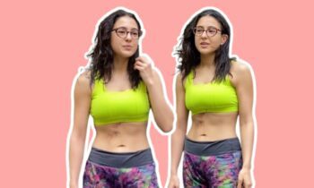 How To Soothe Burn Marks If You Got Them On Your Stomach Like Sara Ali Khan