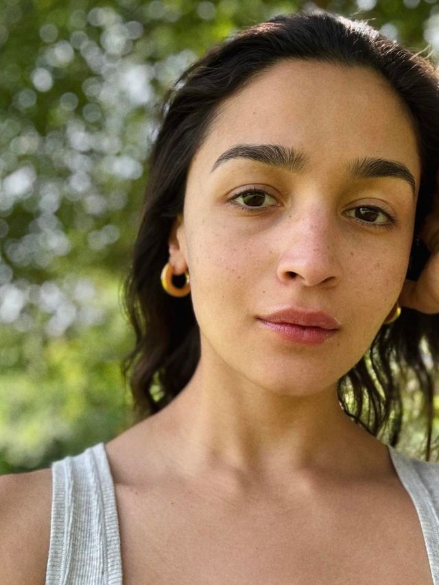 6 Reasons Why You Should Not Follow The Fake Freckles Trend Like Alia Bhatt!