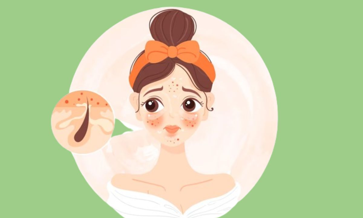 morebeautyImage