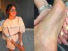 Why Is Priyanka Chopra Rubbing Raw Garlic On Her Feet? This Clever Desi Hack Explained!