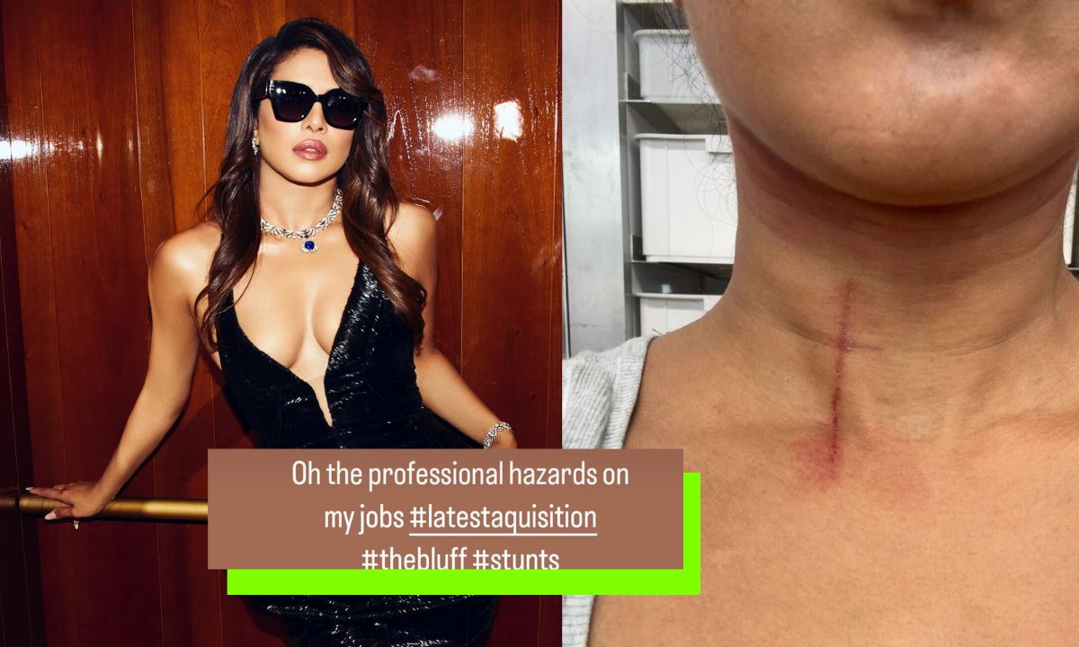 Priyanka Chopra Injured While Shooting For The Bluff With Karl Urban: “Professional Hazards Of My Job” Priyanka Chopra Injured While Shooting For The Bluff With Karl Urban: “Professional Hazards Of My Job”