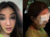 How To Safely Wear Lenses So You Don’t Suffer Corneal Damage Like Jasmin Bhasin? Know All About This Condition