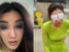 Jasmin Bhasin Suffers Corneal Damage After Wearing Lenses: “I Can’t See And The Pain…”
