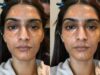 Stop! Orange Colour Corrector Might Not Be The Right Way To Cover Up Your Dark Circles; Here’s Why!