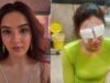 Jasmine Bhasin Reveals Losing Appetite Due To Pain During Corneal Damage, She Was Also Prescribed Sleeping Pills