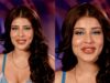 Want Cute Dimples Like Bigg Boss 18 Wildcard Entry Edin Rose? Know All About The Cosmetic Surgery Procedure
