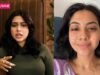 Exclusive: Reem Shaikh: “After The Laughter Chef Incident, Doctor Told Me Scars On My Face Would Be Permanent”