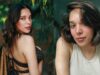 What Is Facial Feminisation Surgery? Here’s Everything You Need to Know