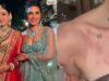 Priyanka Chopra’s Bhabhi Neelam Upadhyaya Gets Skin Allergy After Haldi Ceremony; Asks For Remedies!