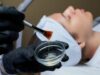Getting A Chemical Peel This Summer? 5 Things To Know Before Booking Your Appointment!