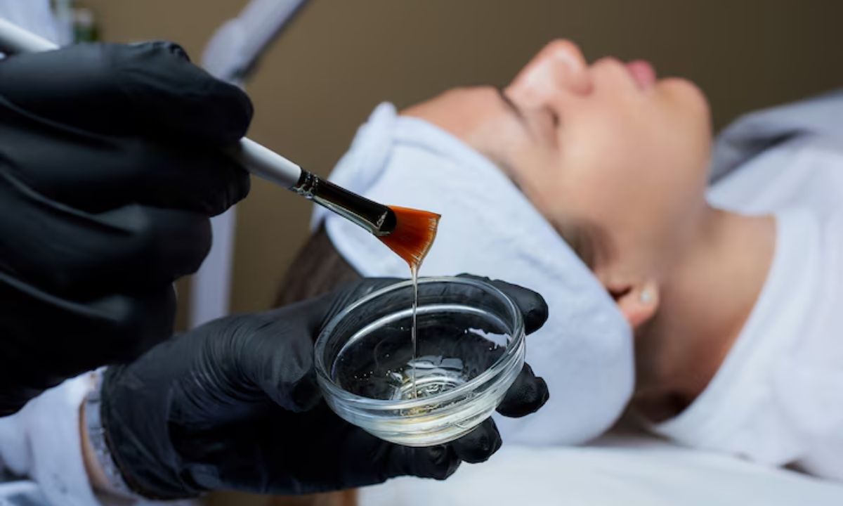Getting A Chemical Peel This Summer? 5 Things To Know About Before Booking Your Appointment!